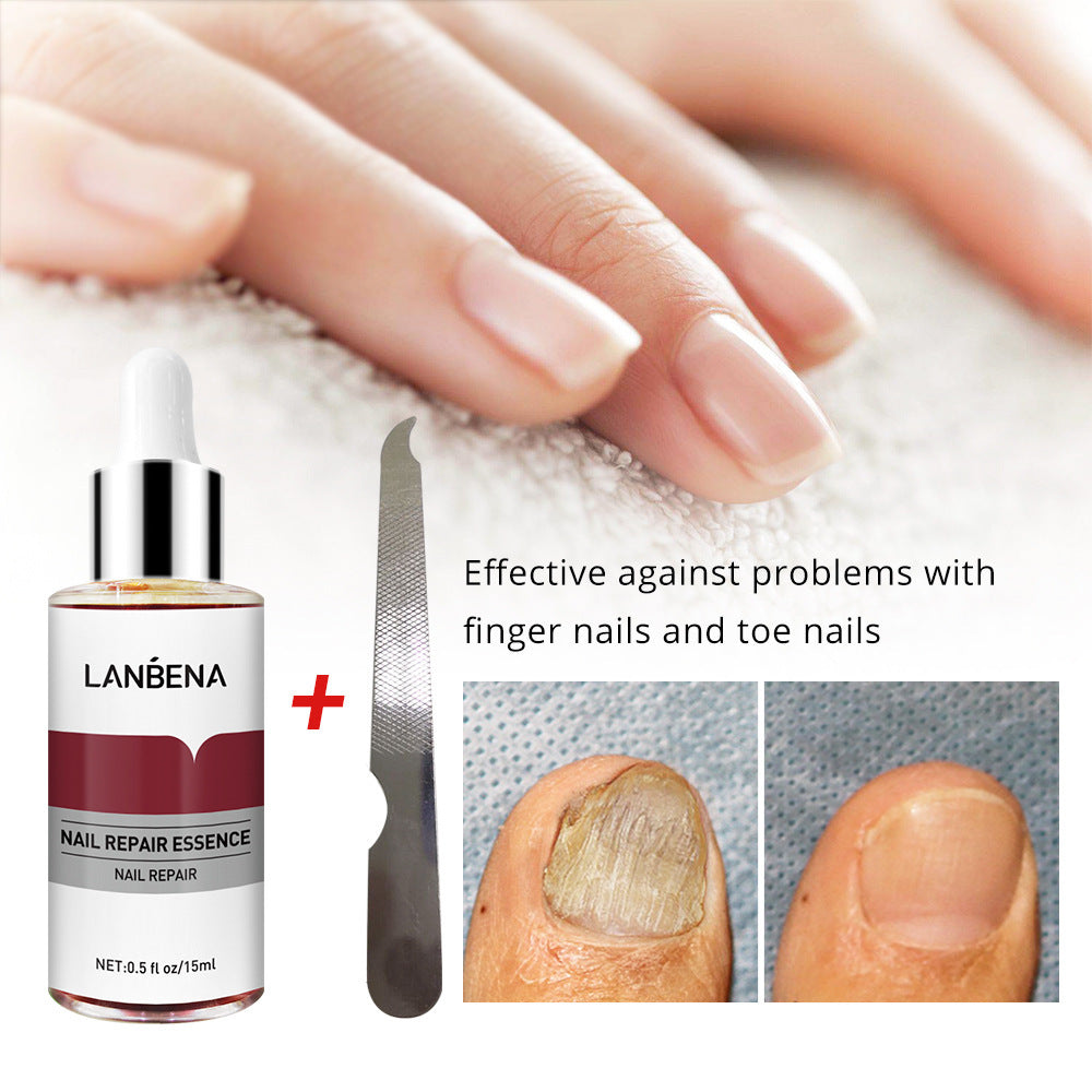 Intensive Nail Strengthening Serum with Natural Extracts Gomaki