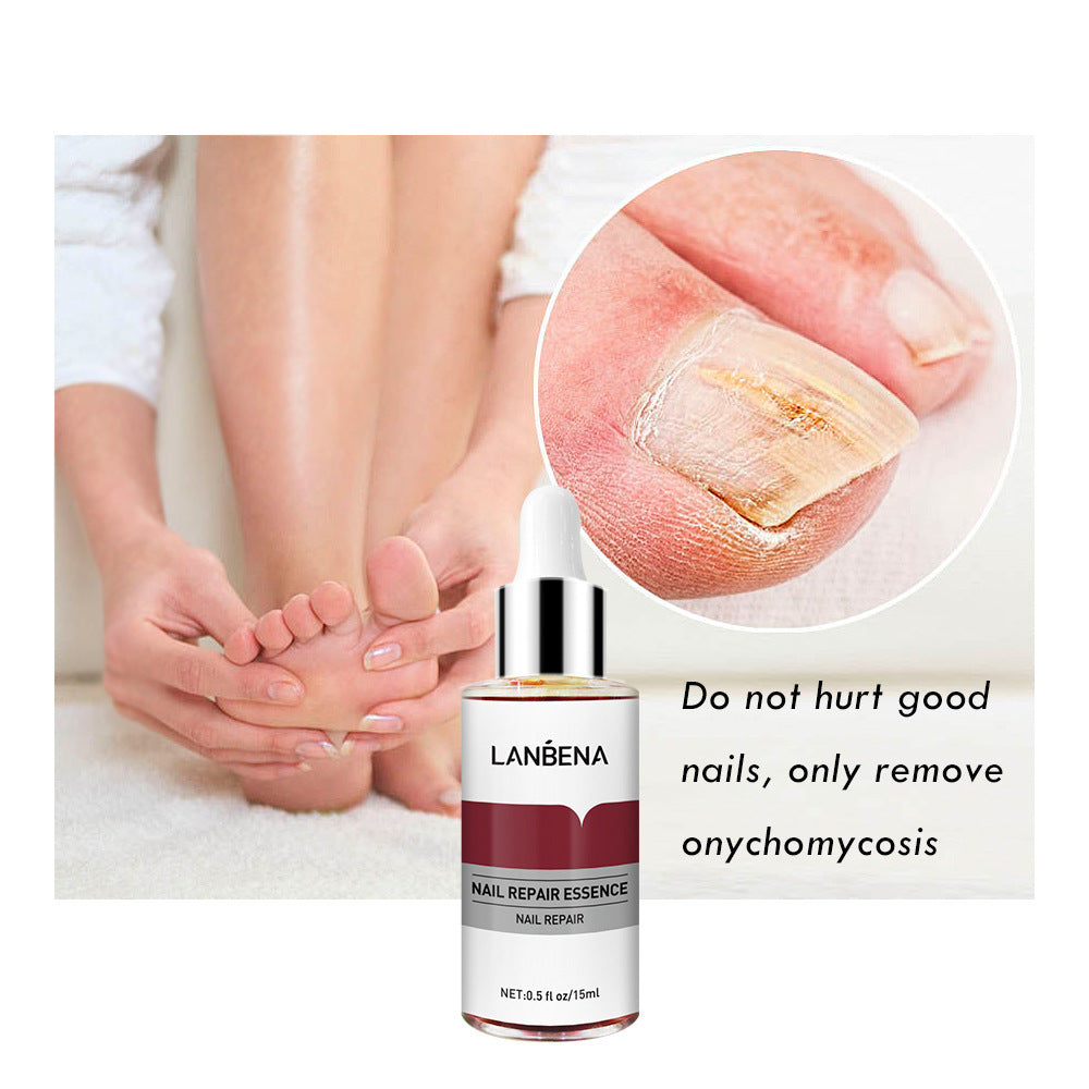 Intensive Nail Strengthening Serum with Natural Extracts Gomaki